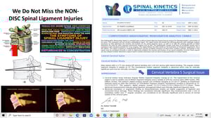 CRMA Determining the Severity and Location of a Spinal Sprain - Thumbnail