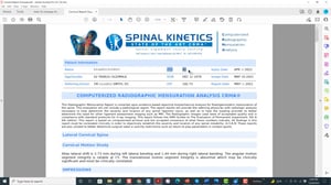 CRMA Results Interpretation in Seconds - Thumbnail