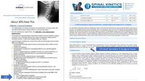 CRMA Shows Potential Spinal Fusion Surgical Needs - Thumbnails