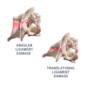 Injury 101 - Mechanism of Injury
