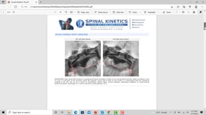 Our CRMA Report Shows Both the 5th and the 6th Edition Impairment Findings - Thumbnail